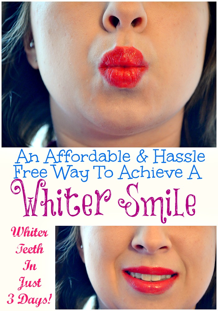 An Affordable & Hassle Free Way To Achieve A Whiter Smile #OpticSmiles