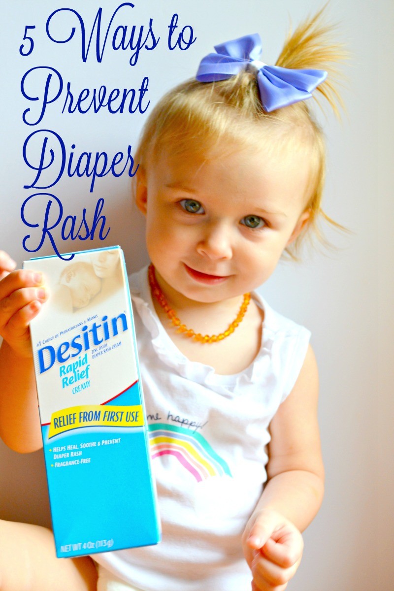 5 Ways to Prevent Diaper Rash