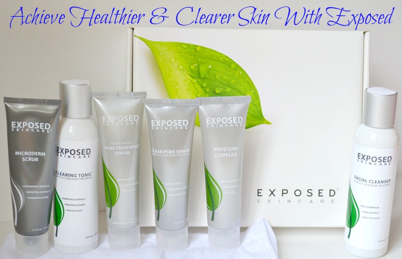 Achieve Healthier & Clearer Skin With Exposed 